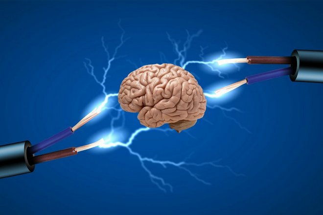 стимуляции мозга могут улучшить память и ускорить приобретение навыков