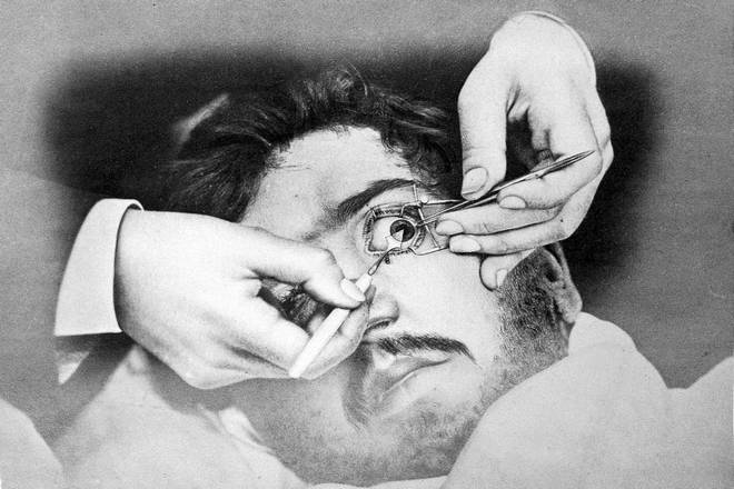 хирург изучает глаз