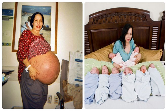 В 2008 году Надя Сулеман вошла в историю, когда родила восьмерых. Повторим, восемь младенцев. И у нее было больше, чем просто небольшая помощь. В этот важный день Надю посетила команда из 46 врачей и медсестер. От зачатия до рождения наука вела Надю и ее детей к успеху.