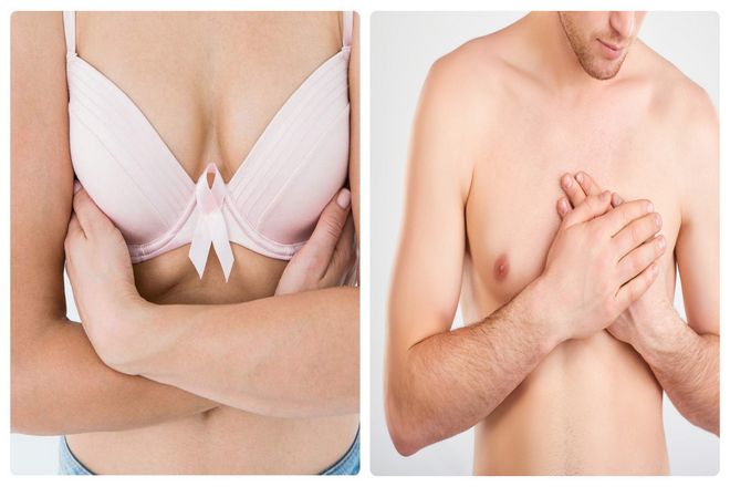Полимастия (избыточная грудь) является относительно распространенным врожденным заболеванием. При котором в дополнение к нормальной ткани молочной железы обнаруживается аномальная добавочная ткань. Однако это может быть незаметно до полового созревания.