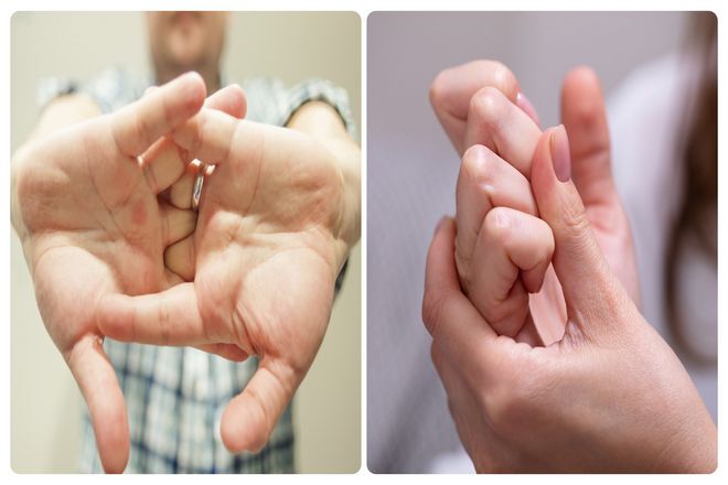 Миф: хруст костяшками пальцев вызывает артрит