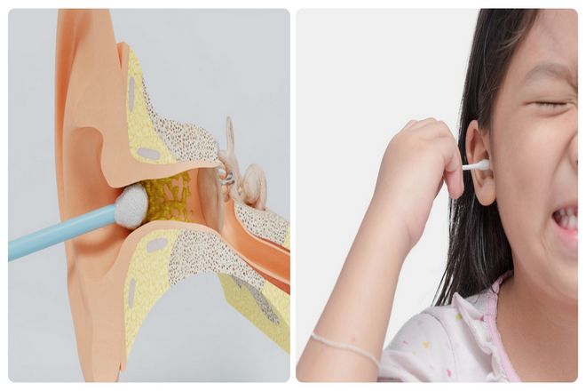 В то время как многие суют ватные палочки в уши, вы, вероятно, знаете, что вам абсолютно не следует этого делать. Если нет, ну теперь вы знаете.