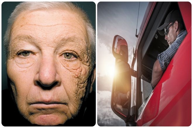 мужчина, изображенный ниже, в течение двадцати восьми лет водил грузовик. Подвергая левую сторону лица большему воздействию солнца.